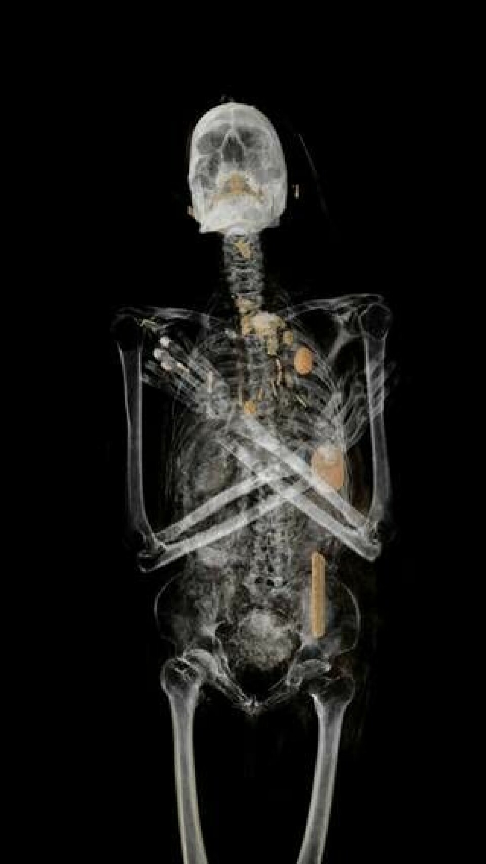 Sammansatta datortomografibilder avslöjar mängder av amuletter på mumiens bröstkorg. En av dem är den nu återskapade falken. Foto: Världskulturmuseerna/Interactive Institute Swedish ICT