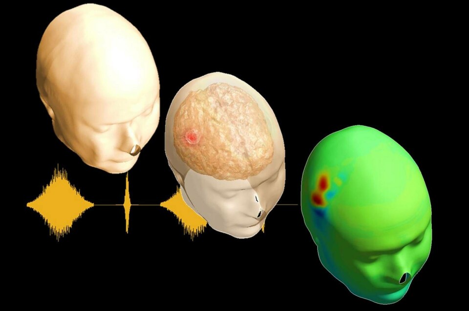 Med hjälp av en svag ström genom hjärnan kan forskarna se om patienten har drabbats av stroke. Metoden kallas för bioimpedans, det vill säga mätning av elektriskt motstånd på biologisk materia. Foto: KTH Med hjälp av en svag ström genom hjärnan kan forskarna se om patienten har drabbats av stroke. Metoden kallas för bioimpedans, det vill säga mätning av elektriskt motstånd på biologisk materia. Foto: KTH