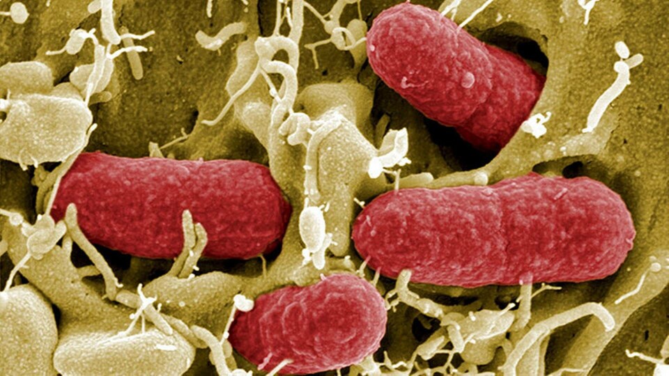 Escherichia coli ett större hot än klimatförändringar hävdar Sally Davies. Foto: TT Escherichia coli ett större hot än klimatförändringar hävdar Sally Davies. Foto: TT