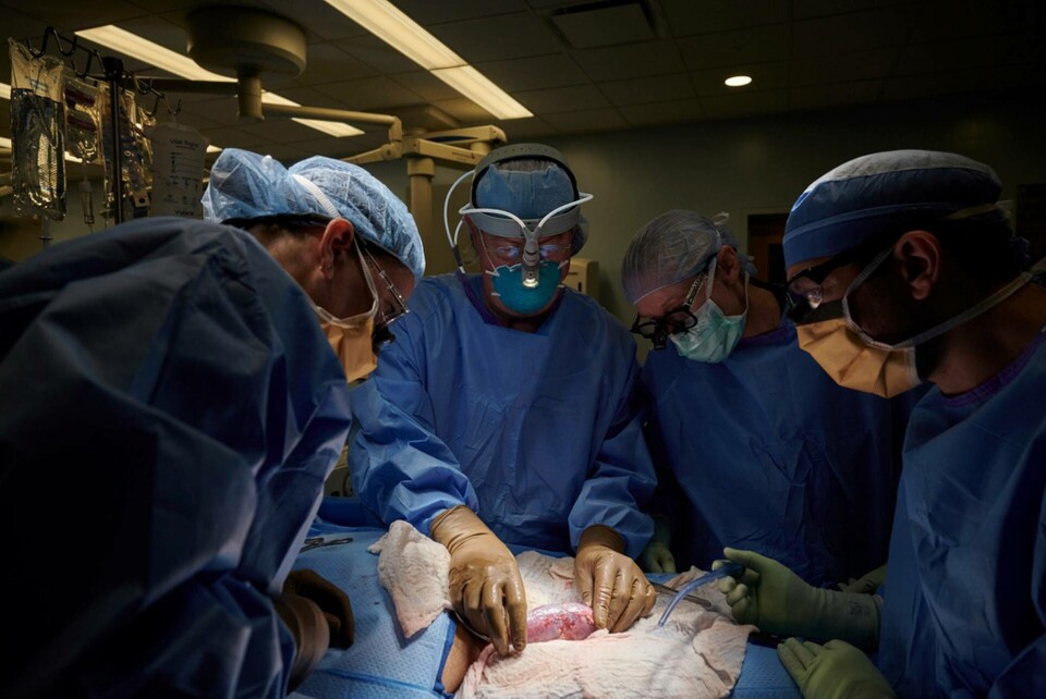 Grisnjuren transplanterades utanför människokroppen för att läkarna skulle kunna följa tillvänjningen bättre. Foto: Joe Carrotta/NYU Langone Health/handout via AP/TT Grisnjuren transplanterades utanför människokroppen för att läkarna skulle kunna följa tillvänjningen bättre. Foto: Joe Carrotta/NYU Langone Health/handout via AP/TT