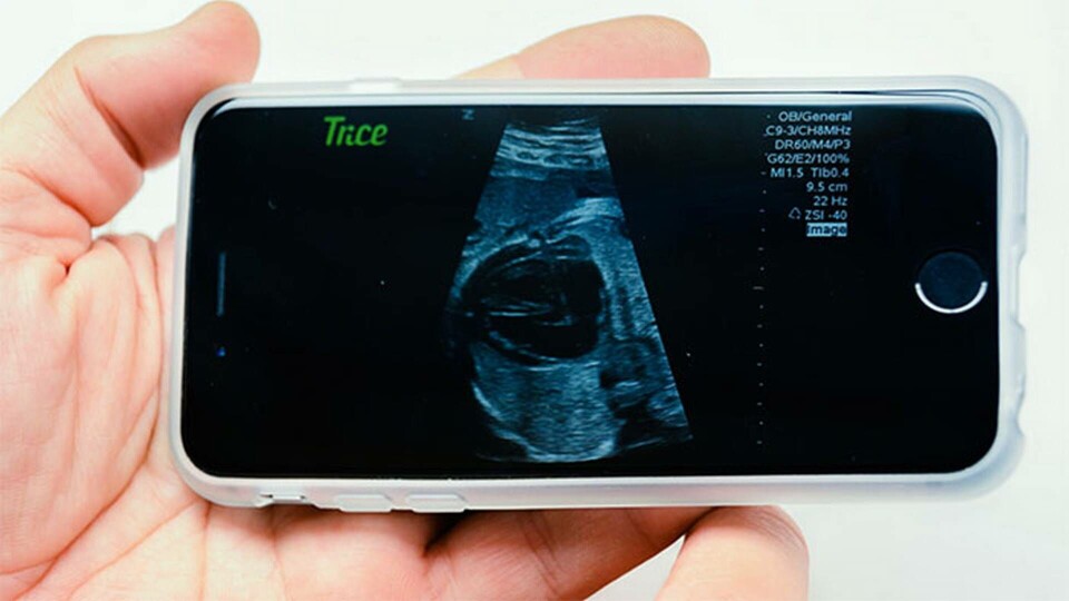 Foto: Trice Imaging Foto: Trice Imaging
