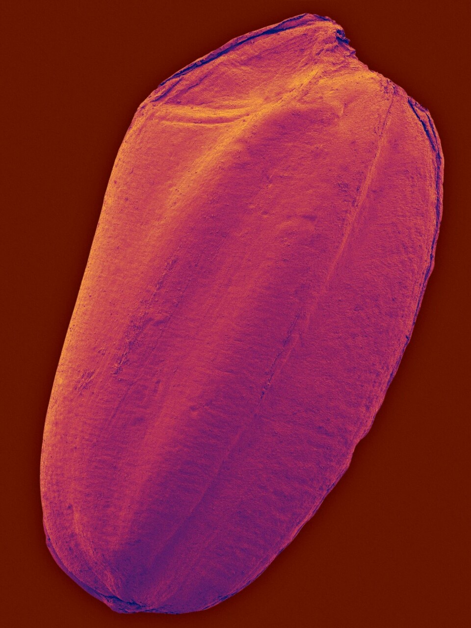 Genmodifierat riskorn av sorten Oryza sativa, även kallat asiatiskt ris, fotograferat via mikroskop. Grödan har genom olika forskningsinsatser bland annat gjorts mer motståndskraftig mot skadedjur. Foto: SCIENCE PHOTO LIBRARY/TT