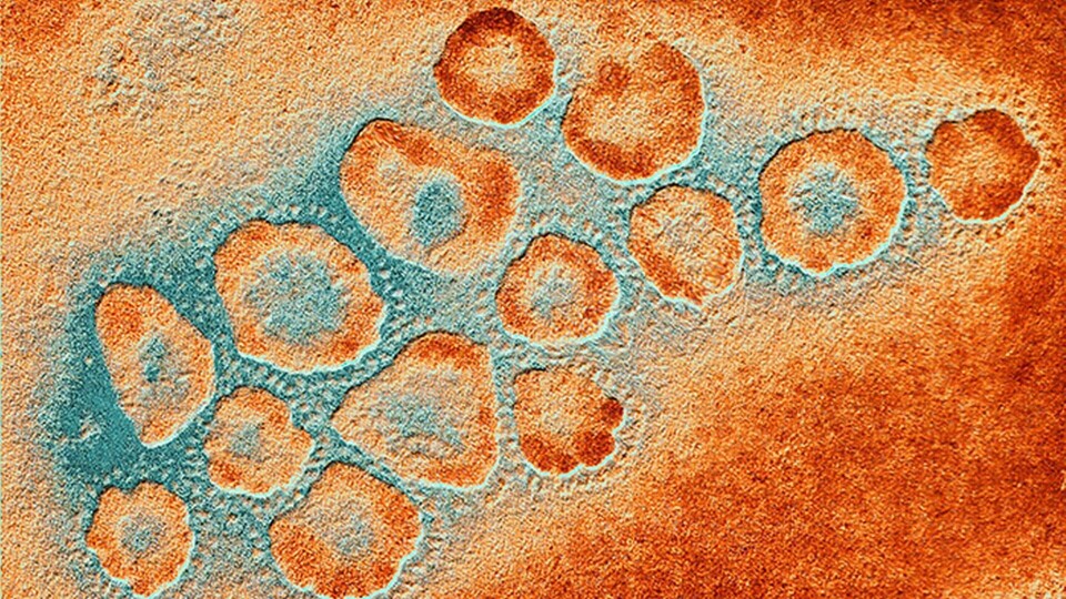 Kluster av coronavirus. Foto: Science Photo Library / TT Kluster av coronavirus. Foto: Science Photo Library / TT