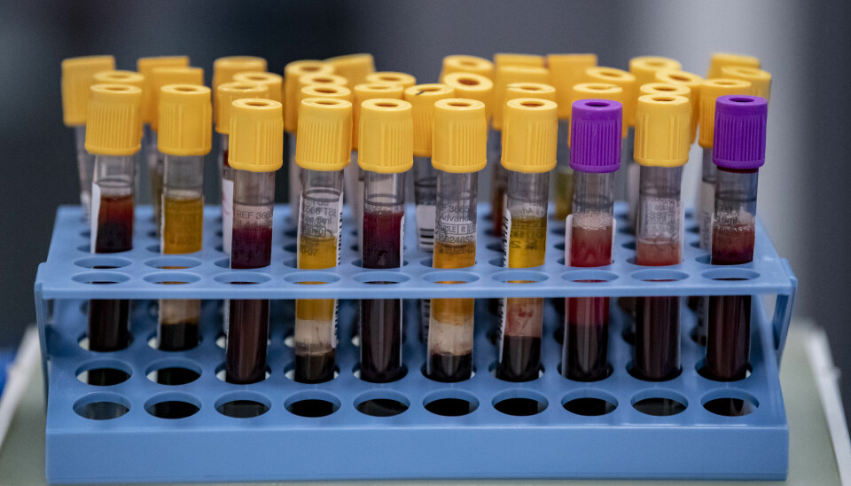 Ett superkänsligt blodprov ska kunna avslöja flera cancerformer.