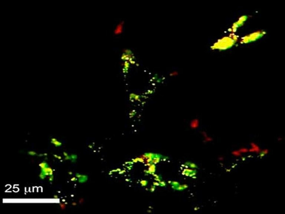Målsökande nanopartikel hittar prostatacancer