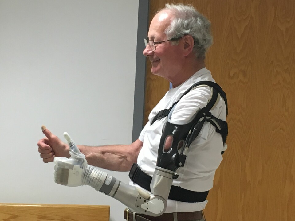 Den högteknologiska armprotesen Luke utvecklad av Defense Advanced Research Projects Agency (Darpa).