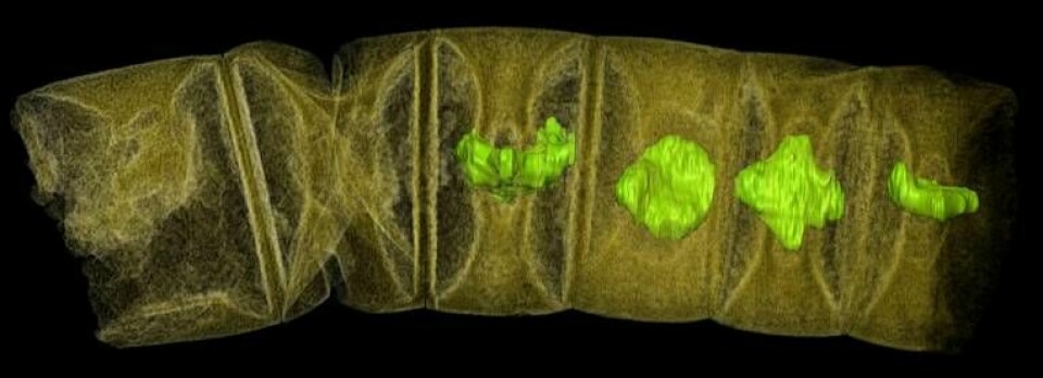 Bild från synkrotonljusmikroskop visar en 1,6 miljarder år gammal trådlik rödalg i ett fossil som är 0,5 millimeter långt. De gröna delarna, där färgen har lagts till i bilden, är enligt forskarna den del av organismer där fotosyntesen äger rum, kloroplaster.