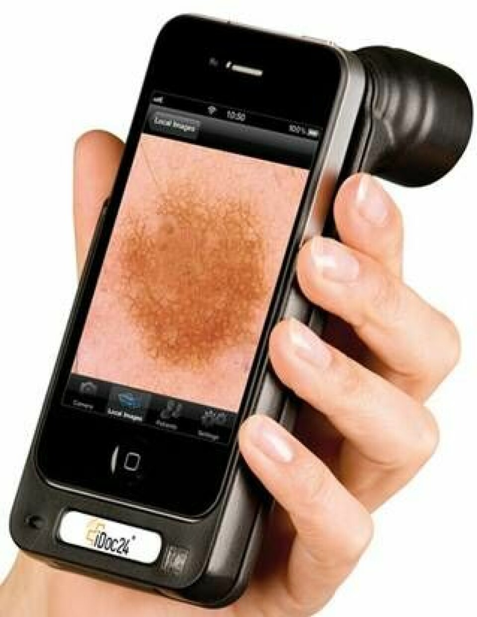 Det medicinska förstoringsglaset Handyscopy förvandlar den smarta telefonen till ett digitalt mikroskop för hudförändringar. Den misstänkta fläcken förstoras 20 gånger innan den skickas vidare tillsammans med en digital remiss.