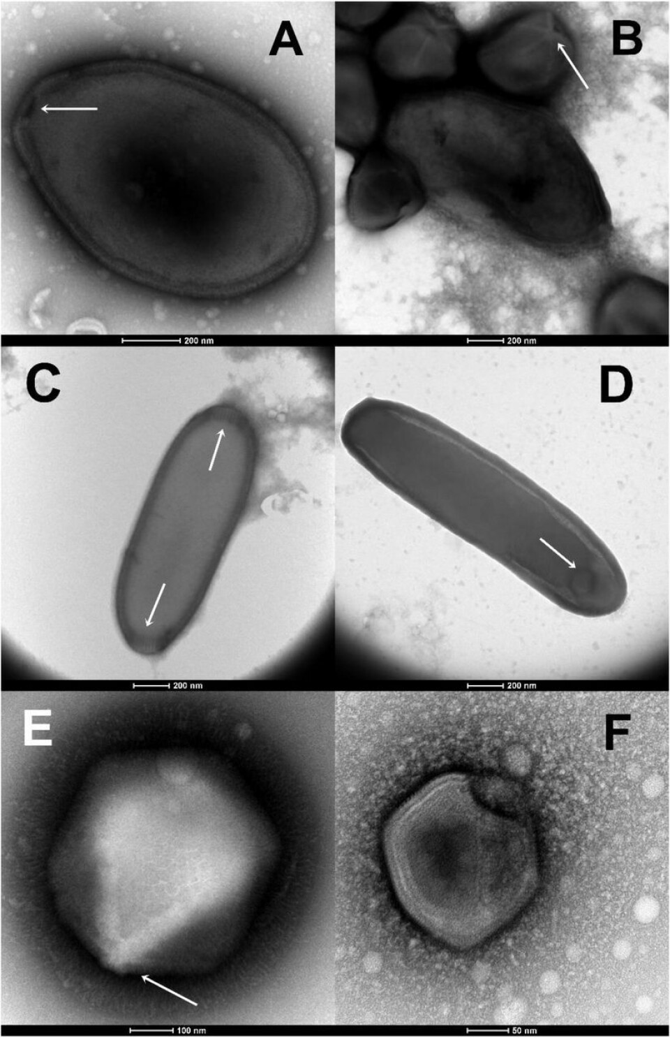 Virus återupplivade av forskarna. Foto: Claverie et al./bioRxiv Virus återupplivade av forskarna. Foto: Claverie et al./bioRxiv