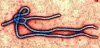 Terrorgruppens plan: Ebola som biovapen