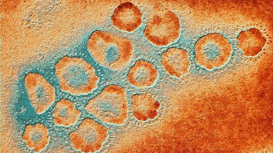 Kluster av coronavirus. Foto: Science Photo Library / TT