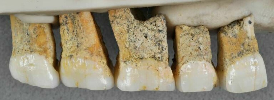 Tänderna som hittade i en grotta på ön Luzon tycks tillhöra en människoart som levde för mer än 50 000 år sedan. Foto: AP