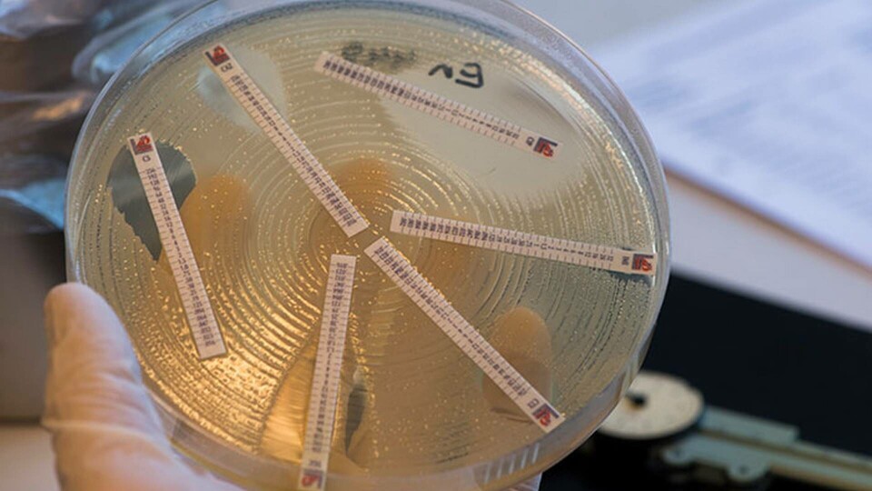 Mätning av resistens och känslighet av antibiotikas effekt på bakterier i en bakterieodling. Folkhälsomyndighetens smittskyddslabb i Stockholm. Foto: TT Mätning av resistens och känslighet av antibiotikas effekt på bakterier i en bakterieodling. Folkhälsomyndighetens smittskyddslabb i Stockholm. Foto: TT