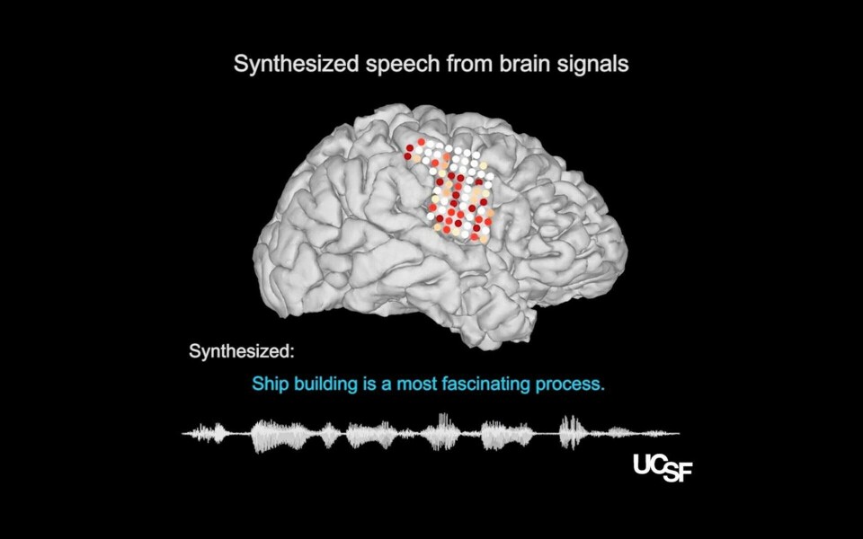 De färgade prickarna visar den registrerade hjärnaktiviteten vid tal. Foto: Chang lab / UCSF Dept. of Neurosurgery De färgade prickarna visar den registrerade hjärnaktiviteten vid tal. Foto: Chang lab / UCSF Dept. of Neurosurgery