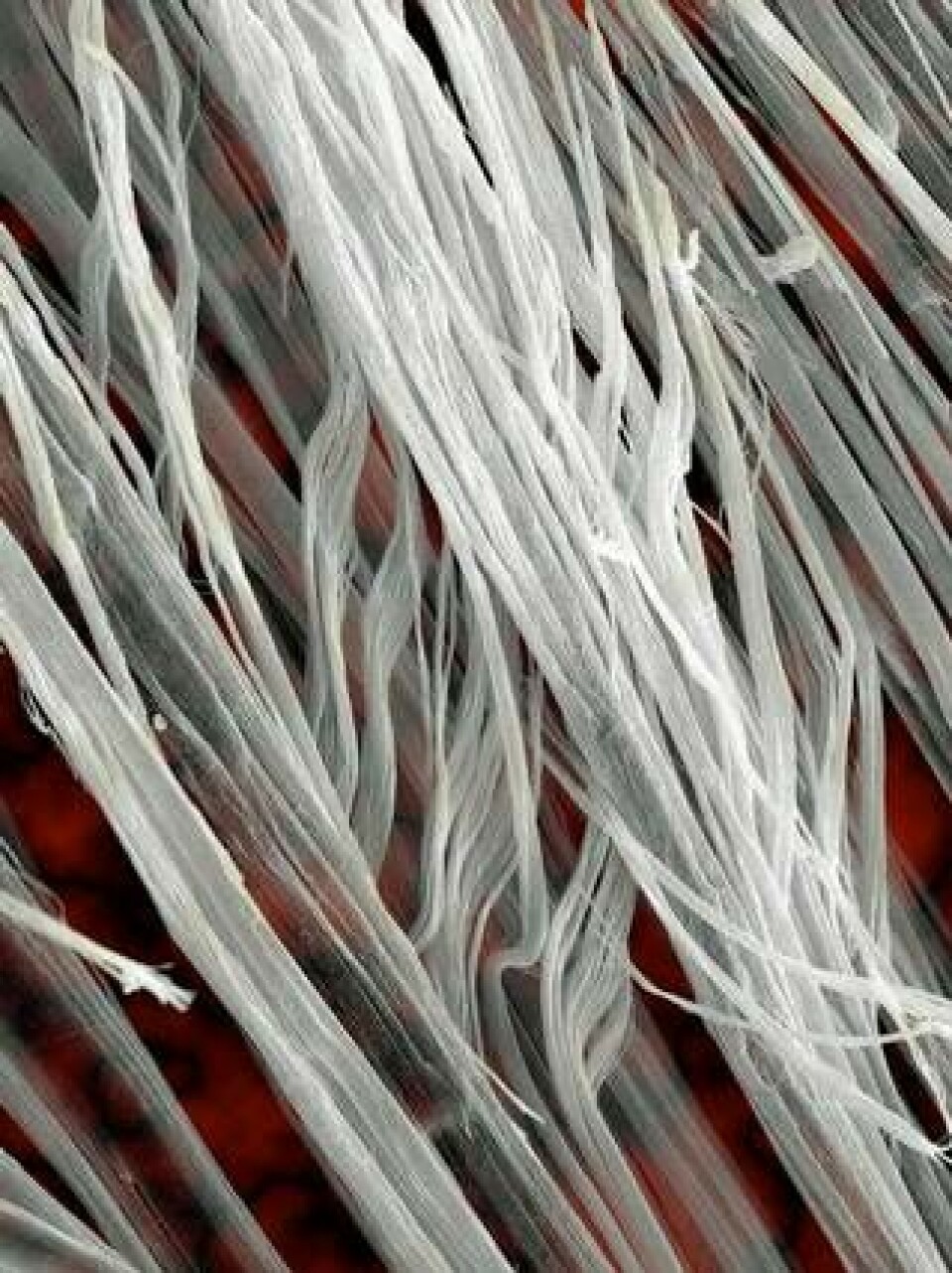 Asbestfibrer i 510 gångers förstoring. Foto: Science Photo Library/IBL