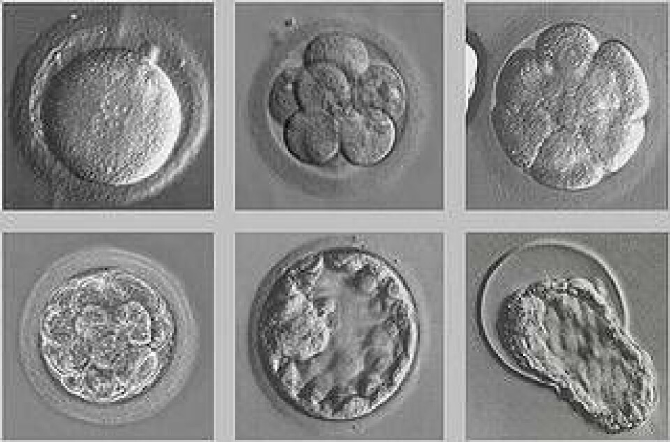Embryot till en människa i åtta steg. Klicka på bilden för större version.