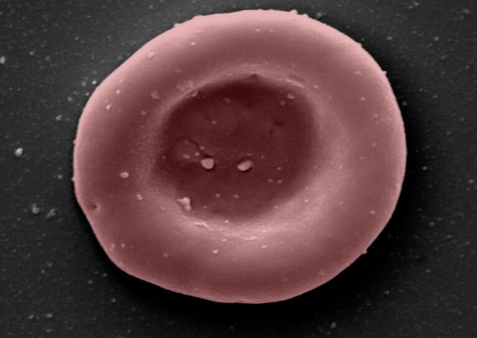 Röd blodcell. Foto: NHS Röd blodcell. Foto: NHS