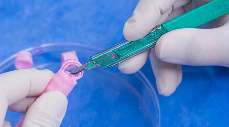 Strupen byggs upp av nanofibrer av PET, polyetylentereftalat. I en bioreaktor odlas ett lager av stamceller från patientens benmärg fram på ytan.CredOSF Saint Francis Medical Center, Peoria, Illinois. Foto: Jim Carlson Strupen byggs upp av nanofibrer av PET, polyetylentereftalat. I en bioreaktor odlas ett lager av stamceller från patientens benmärg fram på ytan.CredOSF Saint Francis Medical Center, Peoria, Illinois. Foto: Jim Carlson