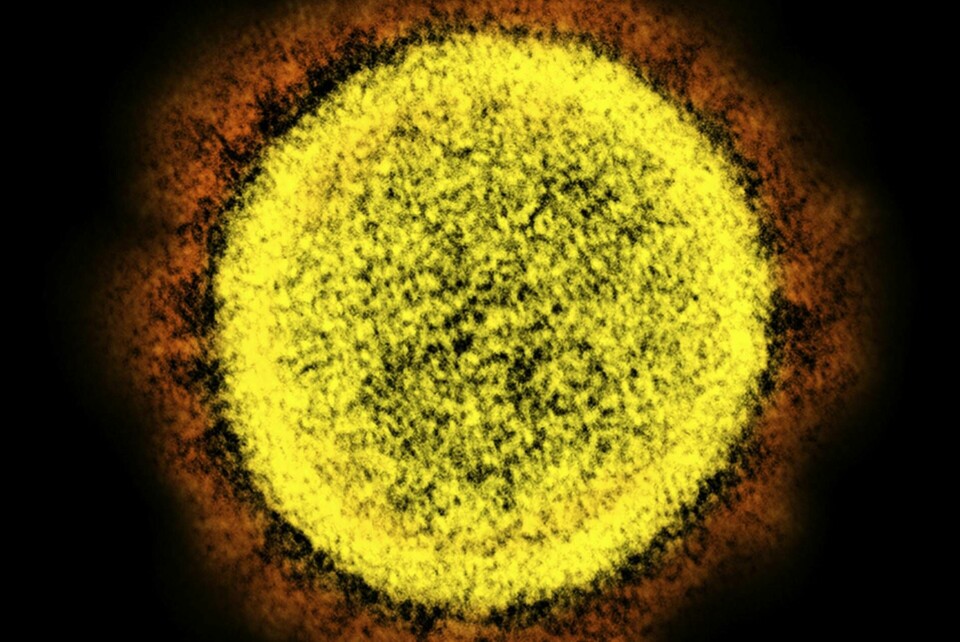 Sars-cov-2 är ett coronavirus, en virusfamilj med minst sju kända virus var av fyra inte orsakar mer än en vanlig förkylning. Foto: NIAID/AP/TT