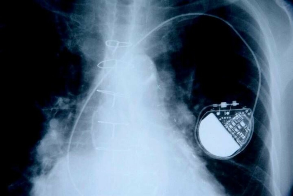 En pacemaker som sitter på plats. Foto: Spencer Grant / Alamy