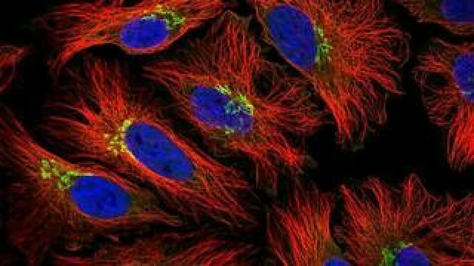 Proteinet GORASP1, bild från The Cell Atlas. Foto: Science for life laboratory