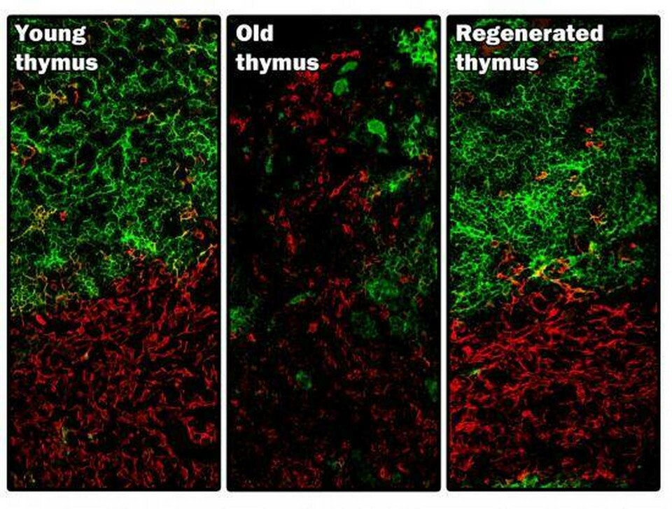 Strukturen och funktionen hos brässen förändras med åren. Forskarna har visat att den går att återställa - i alla fall hos möss.Foto: MRC Centre for Regenerative Medicine, Edinburgh Foto: MRC Centre for Regenerative Medicine, Edinburgh Strukturen och funktionen hos brässen förändras med åren. Forskarna har visat att den går att återställa - i alla fall hos möss.Foto: MRC Centre for Regenerative Medicine, Edinburgh Foto: MRC Centre for Regenerative Medicine, Edinburgh