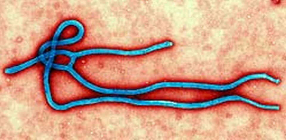 Ebolaviruset. Foto: TT / AP Photo / CDC