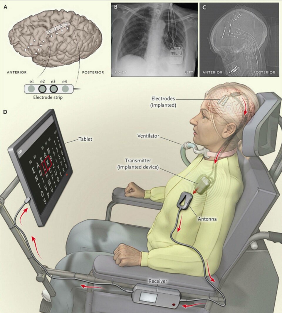 Foto: New England Journal of Medicine Foto: New England Journal of Medicine